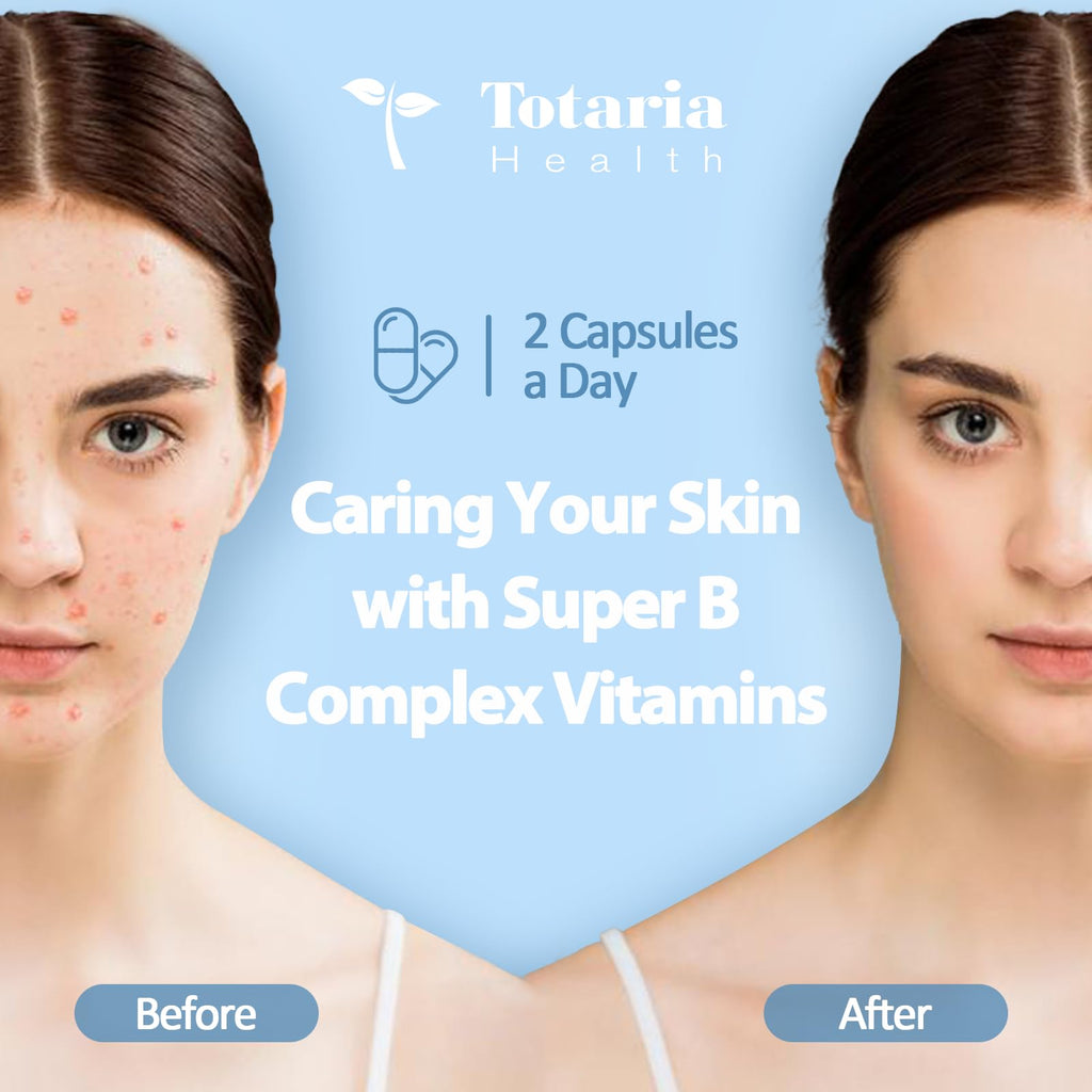 13-in-1 Vitamin B Complex Plus with Vitamin B1, B2, B3 (Niacinamide), B4, B5, B6, B7 (Biotin), B8 (Inositol), B9 (Folate), B12, C, D3, K2 - Energy, Nerve, - FENGGESTORE20
