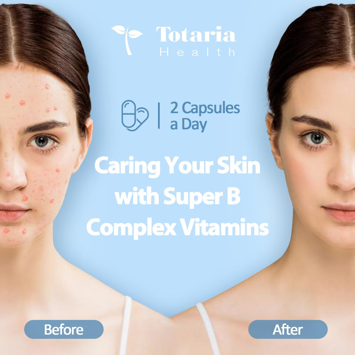 13-in-1 Vitamin B Complex Plus with Vitamin B1, B2, B3 (Niacinamide), B4, B5, B6, B7 (Biotin), B8 (Inositol), B9 (Folate), B12, C, D3, K2 - Energy, Nerve, - FENGGESTORE20