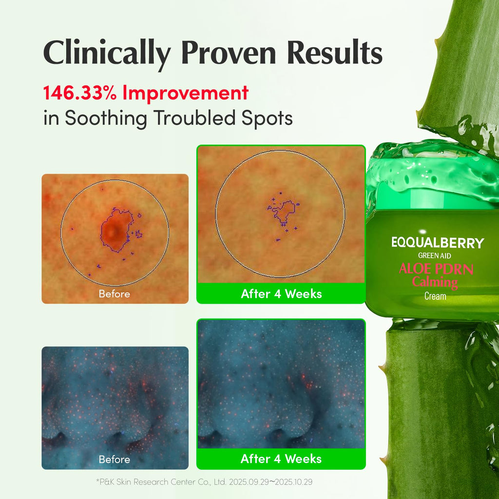 EQQUALBERRY ALOE PDRN Calming Cream | 7% Aloe PDRN & 10% Aloe Vera Water + 5-Cica | Cooling Gel Moisturizer for Oily Skin, Barrier Repair & Blemish Marks