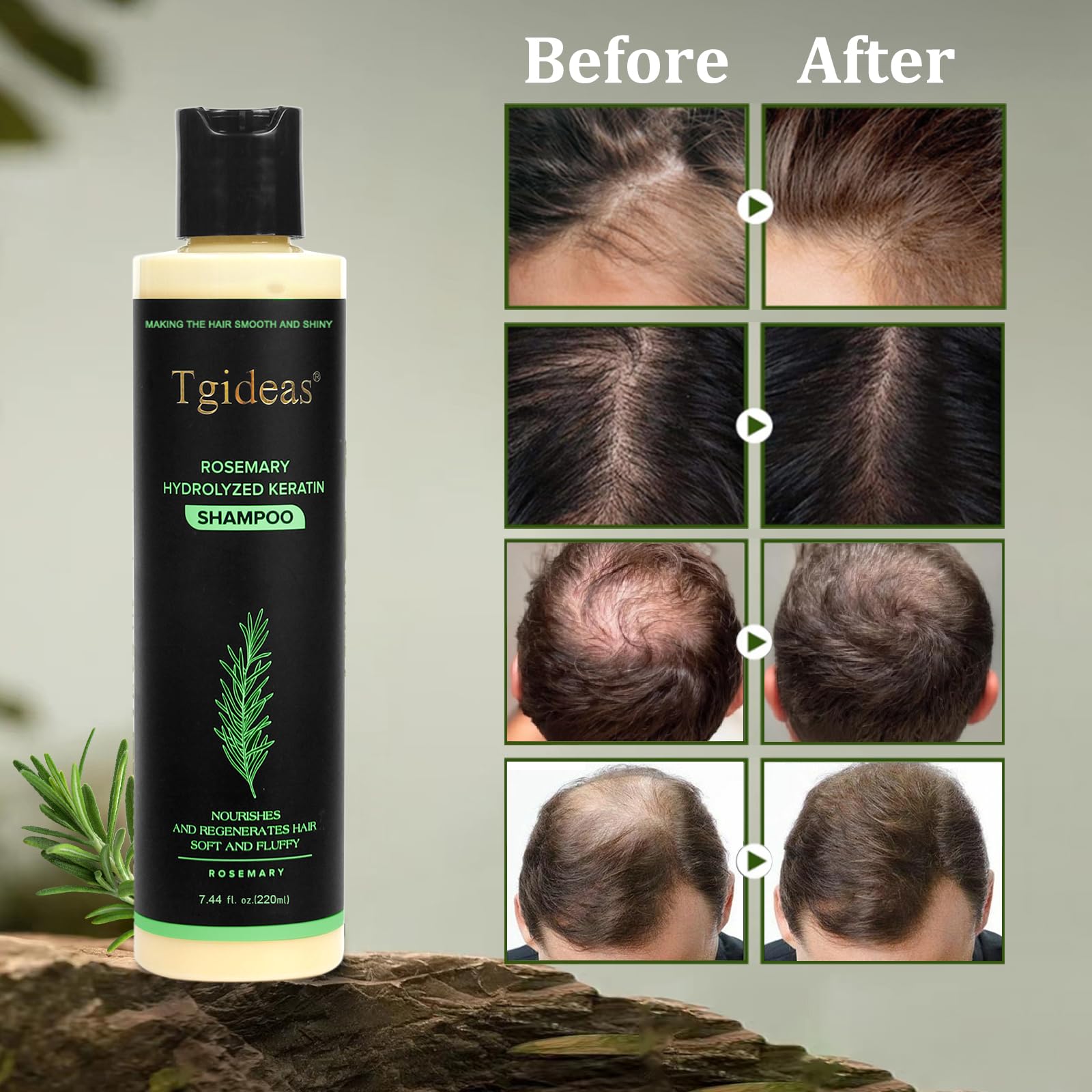 Tgideas Organic Rosemary Hair Growth Shampoo for Women and Men-Natural Thickening & Strengthening Shampoo with Hydrolyzed Keratin