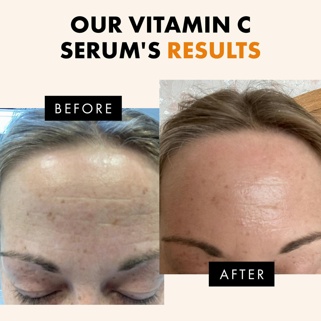 Eclat Skincare Vitamin C Serum - Skin Care for Dark Spots, Vitamin C Serum for Face with Hyaluronic Acid, Ferulic Acid, & Vit E