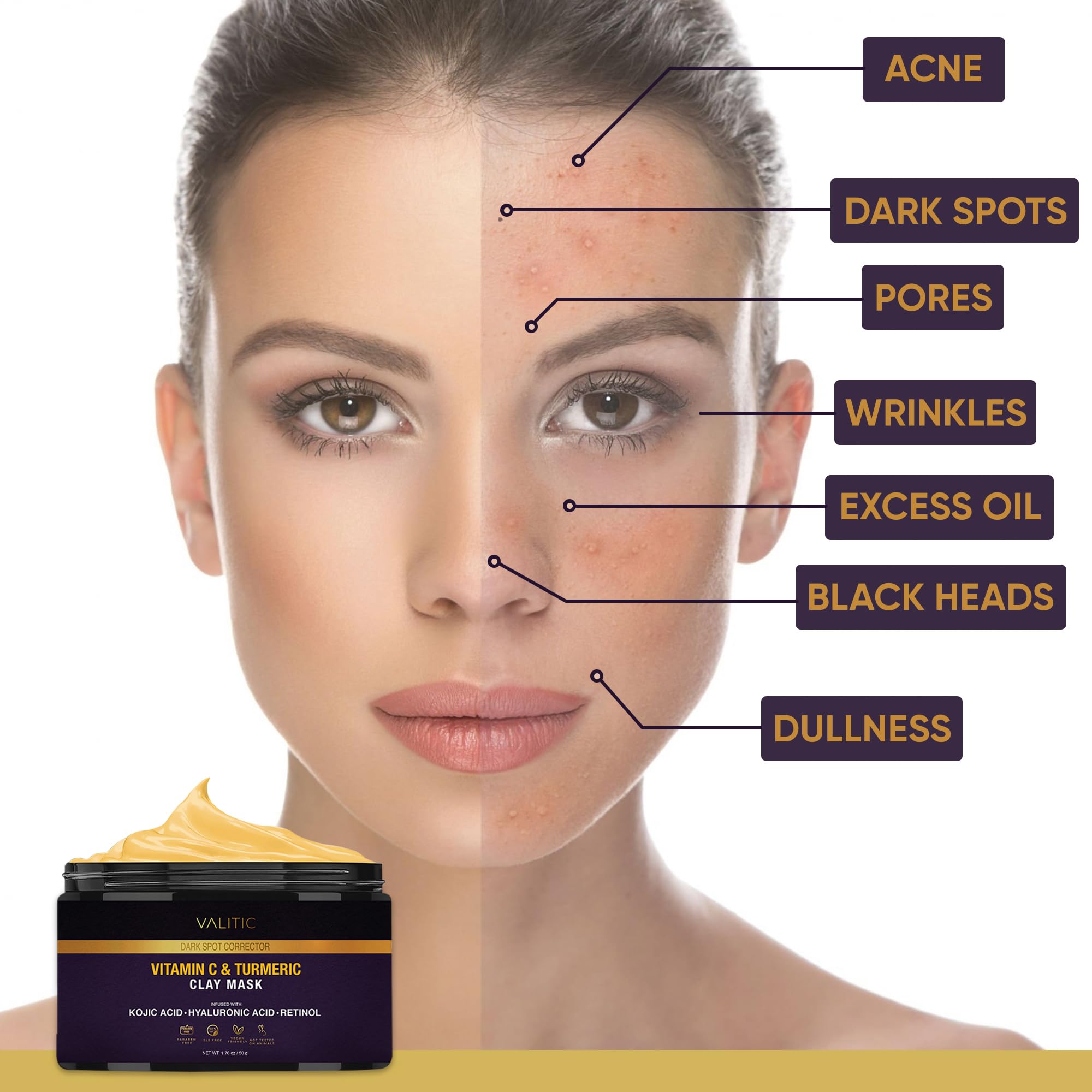 VALITIC Vitamin C & Turmeric Clay Mask - Dark Spot Corrector with Kojic Acid, Hyaluronic Acid & Retinol - Skin Care Routine for Minimizing Pores & Blackheads