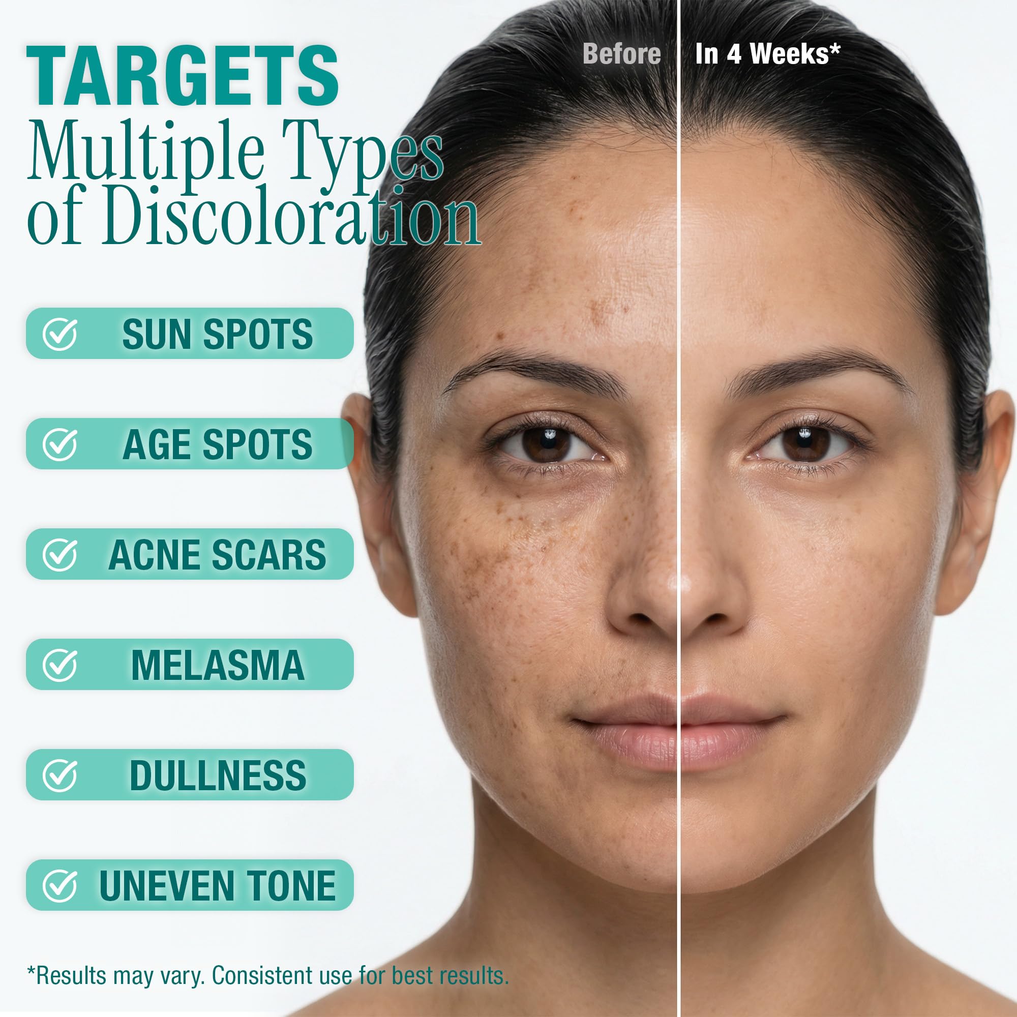 Ebanel Dark Spot Remover for Face & Body, Brightening Serum with Synovea HR, Alpha Arbutin, Niacinamide, Kojic Acid, Dark Spot Corrector for Hyperpigmentation, Discoloration, Melasma and Age Spots