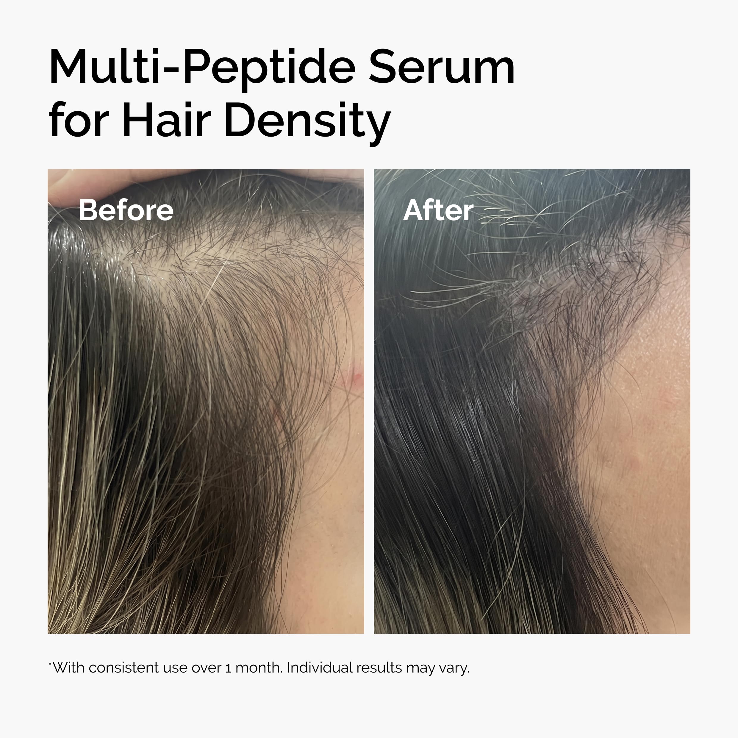 The Ordinary Multi-Peptide Serum for Hair Density, Peptide-Powered Formula for Thicker, Fuller Looking Hair, 2 Fl Oz