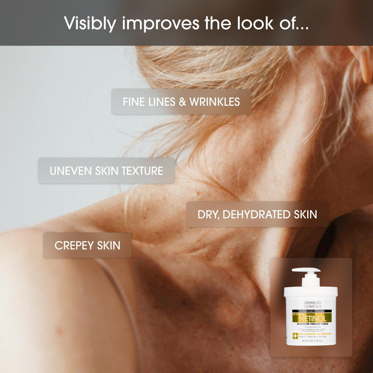 Advanced Clinicals Retinol Body Lotion & Face Moisturizer | Visible Anti Aging Skin Care Retinol Body Cream For Women & Men Targets Look Of Fine Lines - FENGGESTORE20