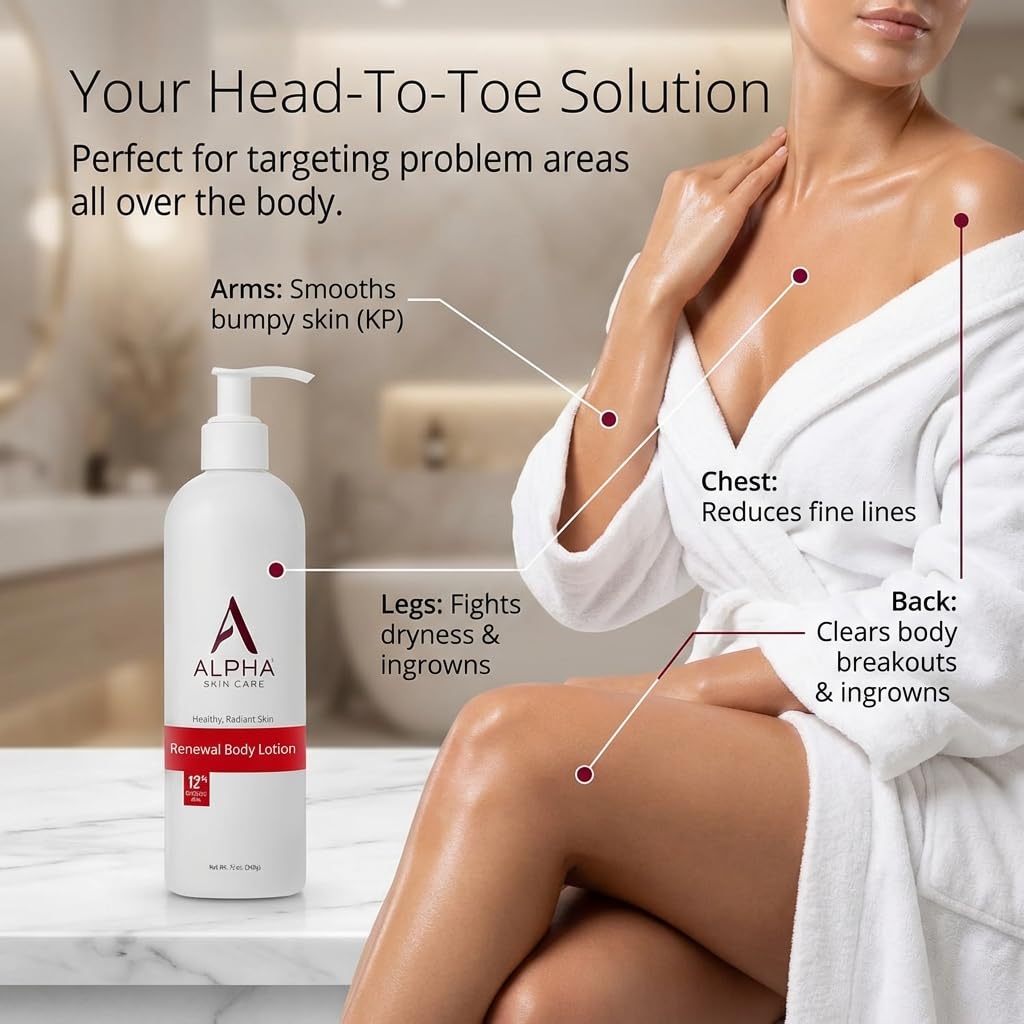 Alpha Skin Care Revitalizing Body Lotion, 12% Glycolic AHA, Simple & Effective Daily Moisturizer with Alpha Hydroxy Acid - FENGGESTORE20