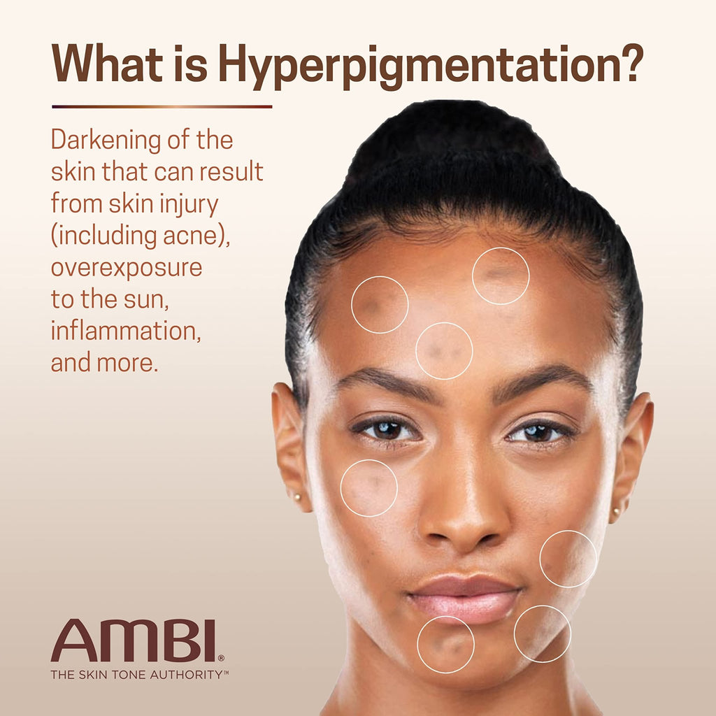 Ambi Even & Clear Advanced Fade Cream, Hydroquinone-free, Hyperpigmentation Treatment, Stubborn Dark Spot Corrector, Results In As Little As 2-3 Weeks - FENGGESTORE20