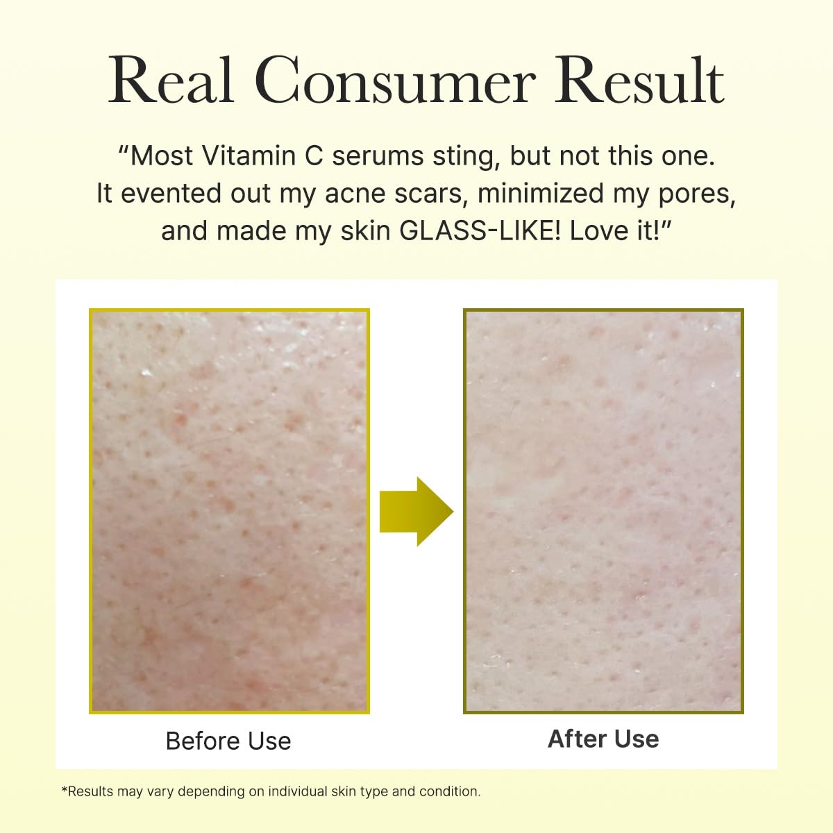 Arencia Vitamin C Booster Shot Serum with Glutathione, Niacinamide and Vitamin E for Dark Spot Care, Fine Lines & Wrinkles - FENGGESTORE20