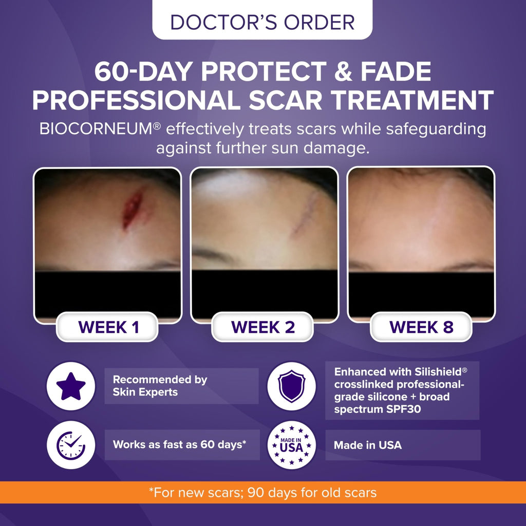 Biocorneum Advanced Scar Treatment with Silishield® & SPF 30 10g – Medical Grade Silicone Gel to Support Healing of Surgical Scars and Marks - FENGGESTORE20