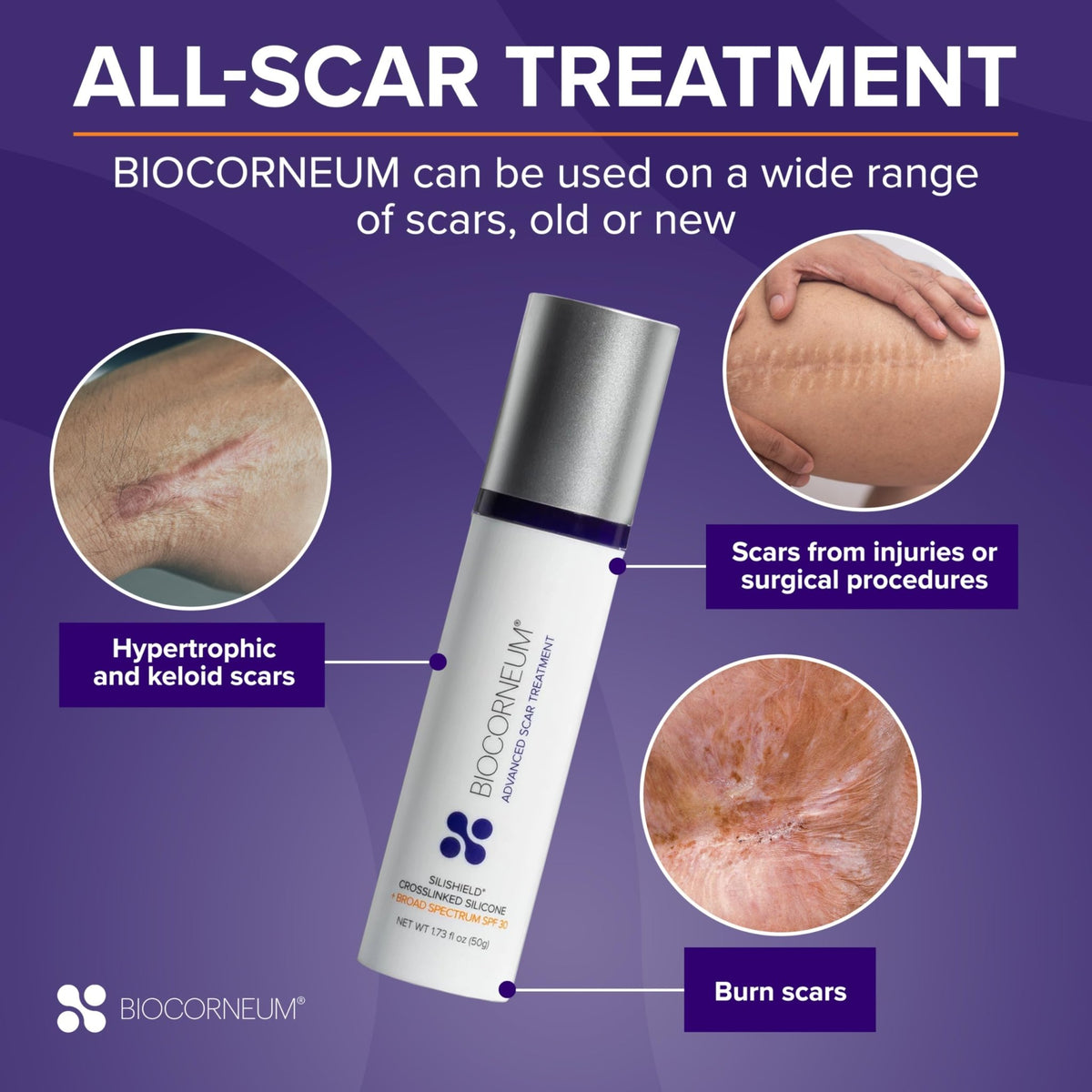 Biocorneum Advanced Scar Treatment with Silishield® & SPF 30 10g – Medical Grade Silicone Gel to Support Healing of Surgical Scars and Marks - FENGGESTORE20