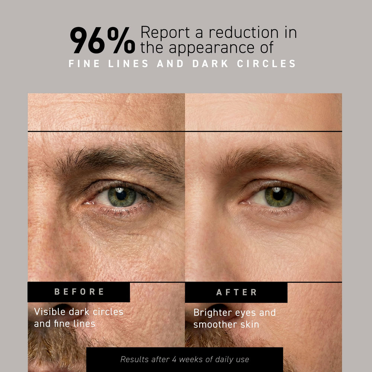Brickell Men's Restoring Under Eye Cream for Men, Natural and Organic Anti Aging Eye Balm To Reduce Puffiness, Wrinkles, Dark Circles - FENGGESTORE20