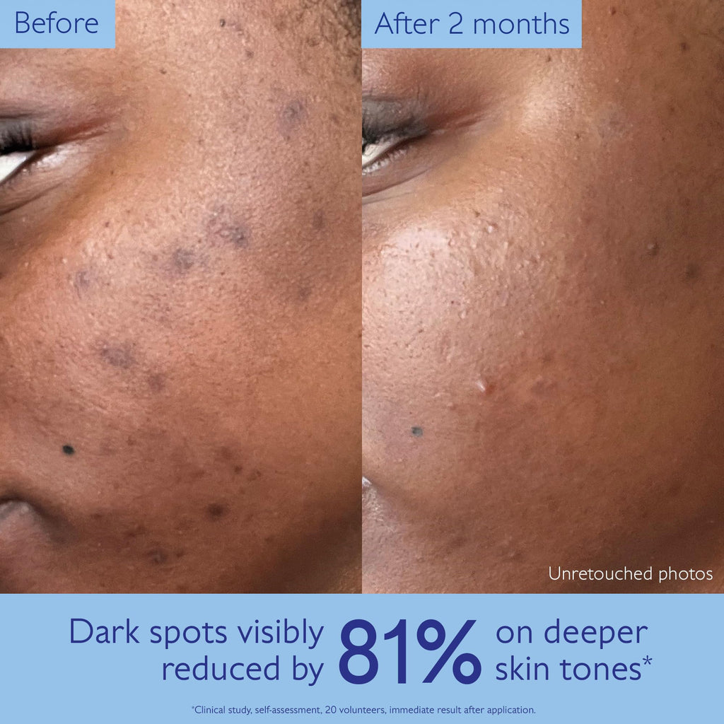 Caudalie Vinoperfect Brightening Dark Spot Serum Vitamin C Alternative - 62x More Effective than Vitamin C with Viniferine - FENGGESTORE20