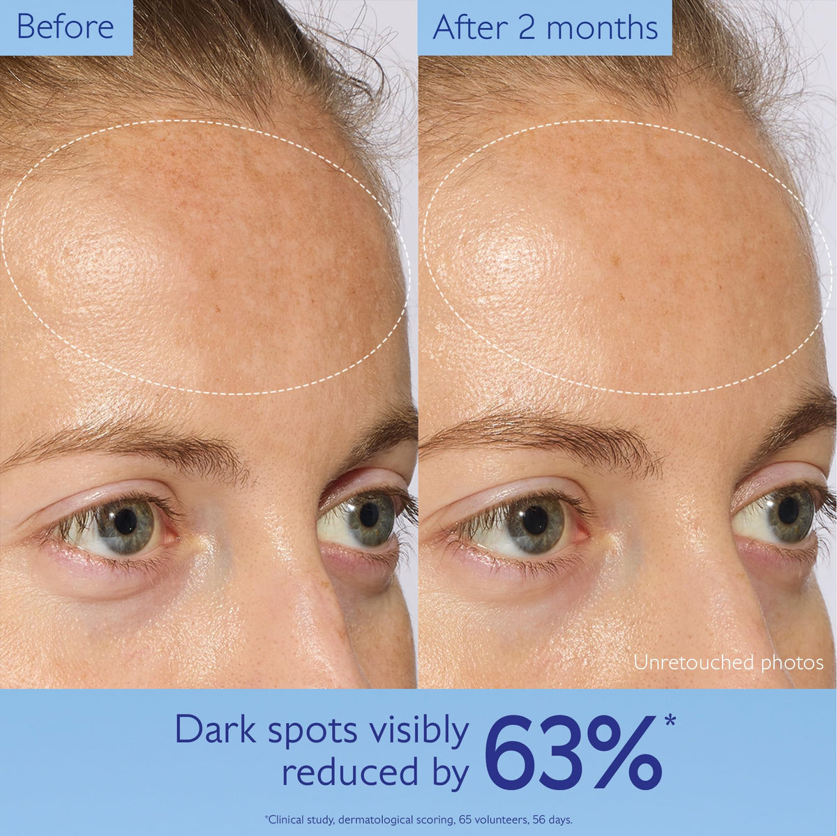 Caudalie Vinoperfect Brightening Dark Spot Serum Vitamin C Alternative - 62x More Effective than Vitamin C with Viniferine - FENGGESTORE20