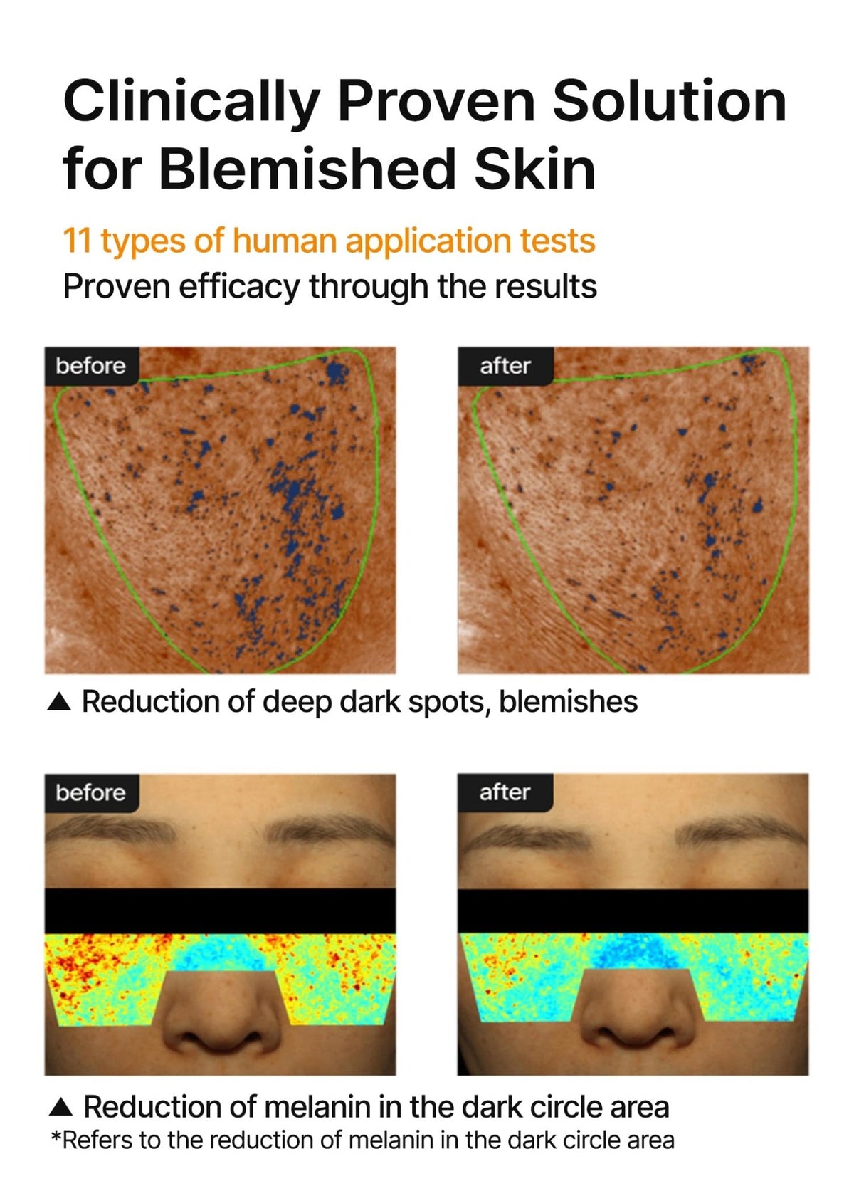 celimax Pore+Dark Spot Brightening Cream | with Niacinamide, Tranexamic Acid, TXA Cream - FENGGESTORE20