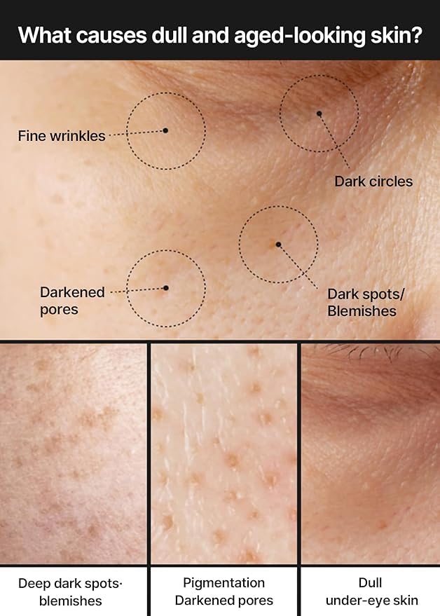 celimax Pore+Dark Spot Brightening Cream | with Niacinamide, Tranexamic Acid, TXA Cream - FENGGESTORE20