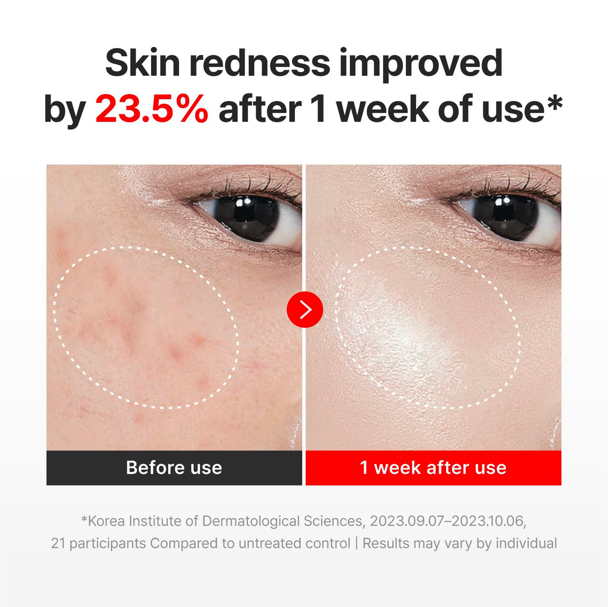 CENTELLIAN 24 Madeca Cream Time Reverse (1.69 fl oz) - TECA Centella Asiatica Glow Face Cream Moisturizer, Hydrating - FENGGESTORE20