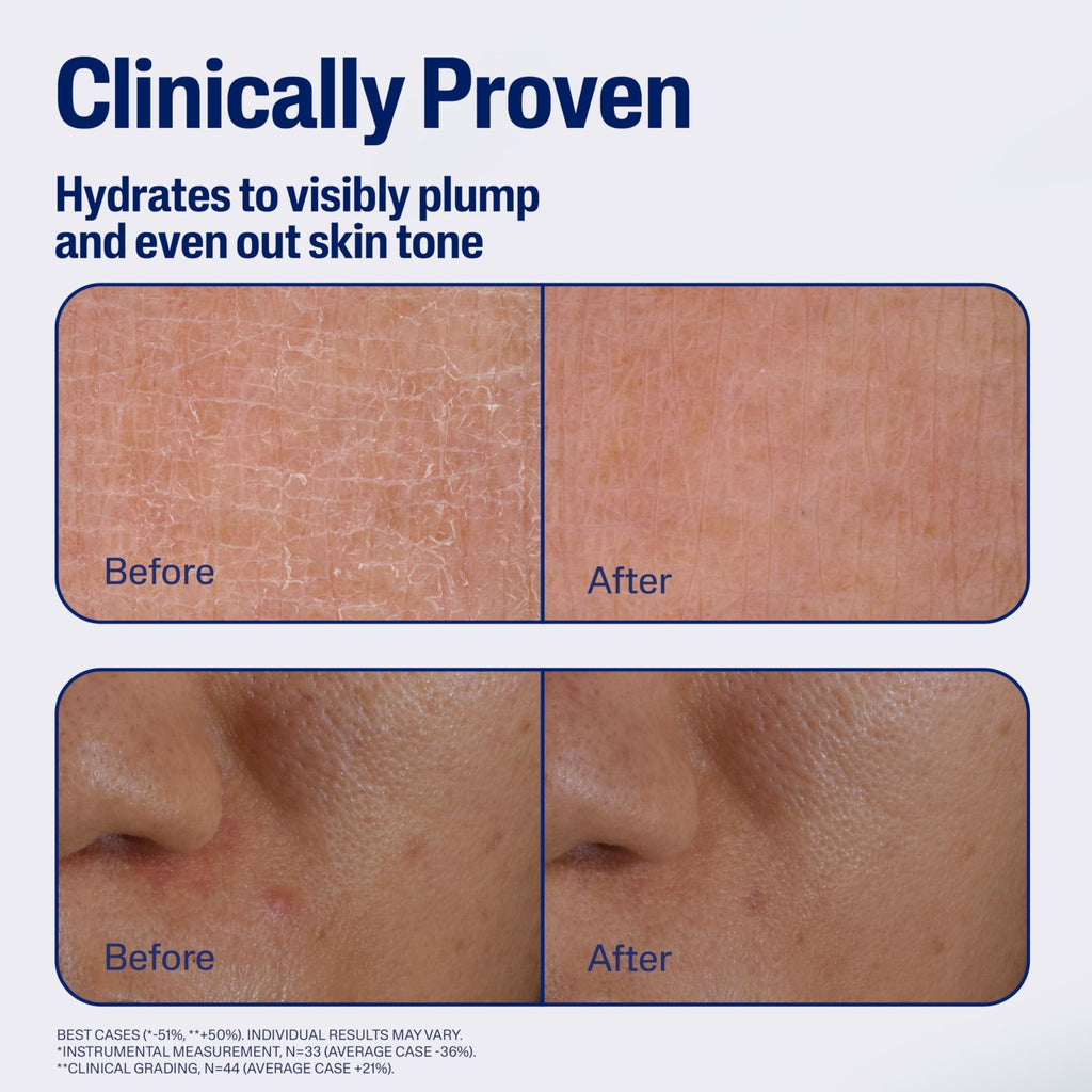 CETAPHIL Repair & Renew Night Serum for Stressed Sensitive Skin with Gallic Acid & Vitamin E, PM Face Serum, Repairs Skin Barrier Overnight - FENGGESTORE20