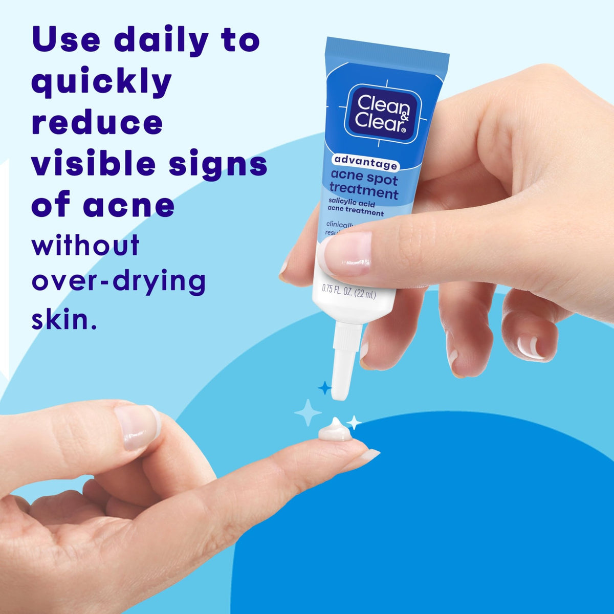 Clean and Clear Advantage Acne Spot Treatment Gel Cream with 2% Salicylic Acid & Witch Hazel, Acne Pimple Medication - FENGGESTORE20