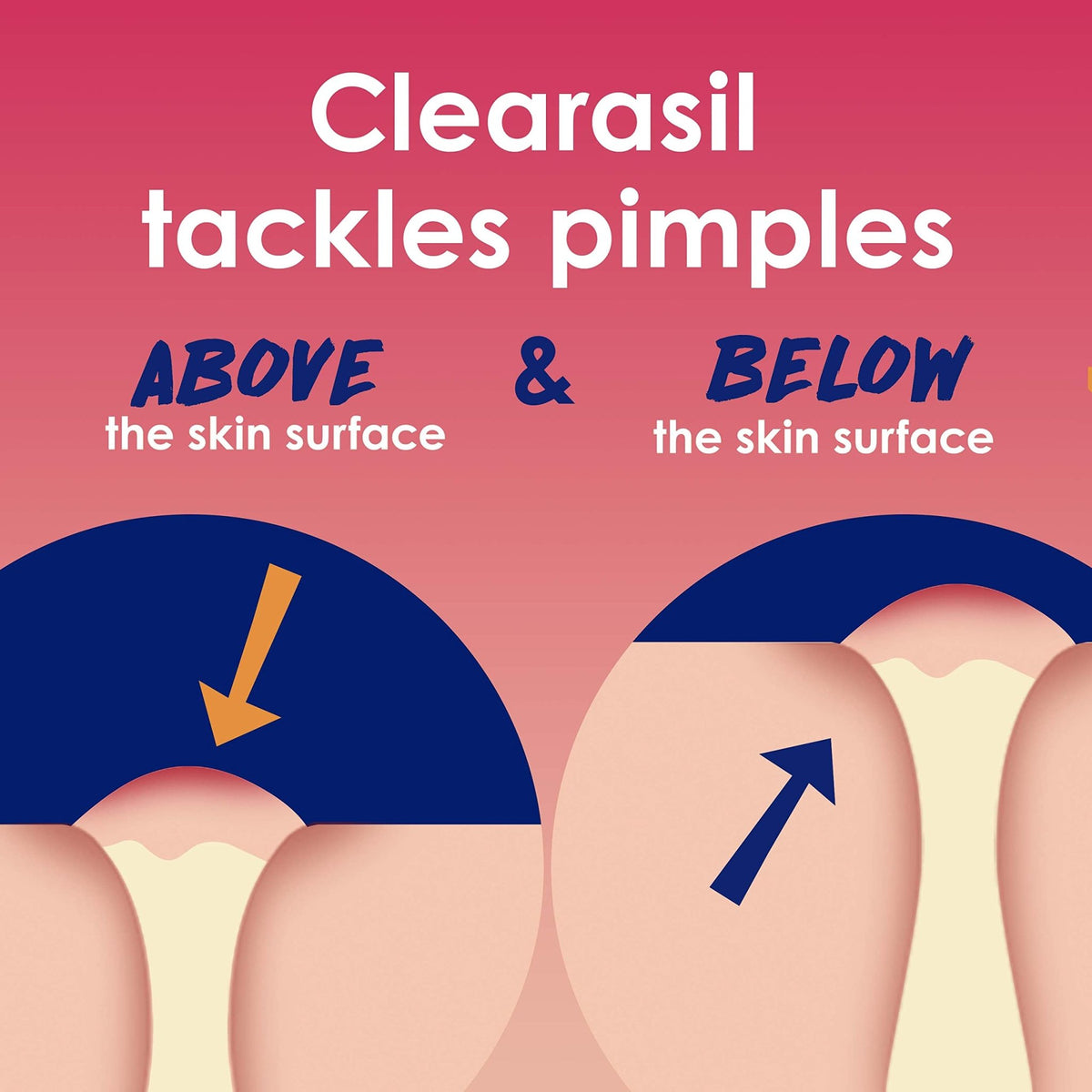 Clearasil Rapid Rescue Deep Treatment Acne Face Pads, Maximum Strenght with 2% Salicylic Acid Acne - FENGGESTORE20