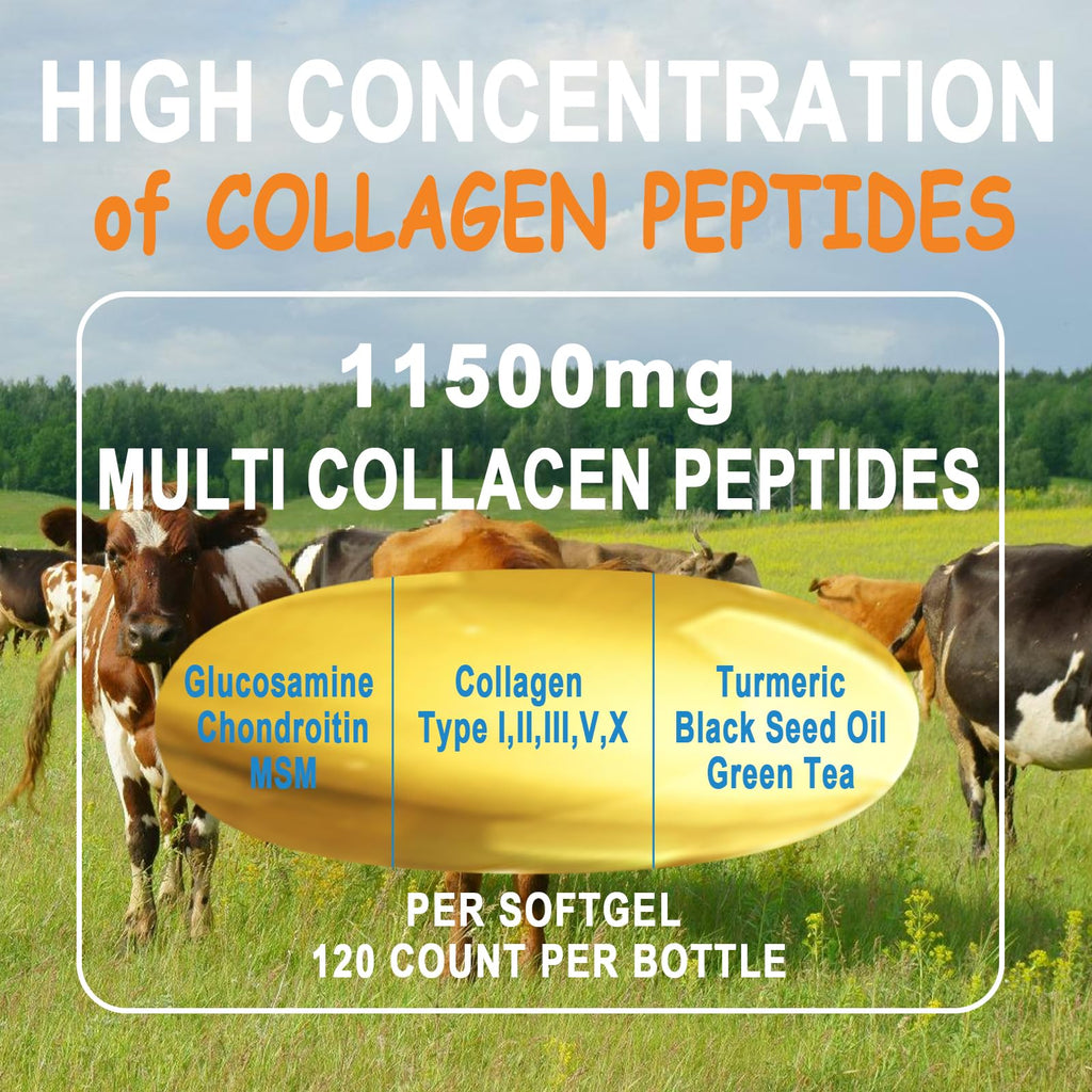 Collagen Peptides Softgels, Multi Collagen Peptide w/ Glucosamine Chondroitin MSM Biotin, Hydrolyzed Collagen Peptides Complex for Women Supports Skin Hair - FENGGESTORE20