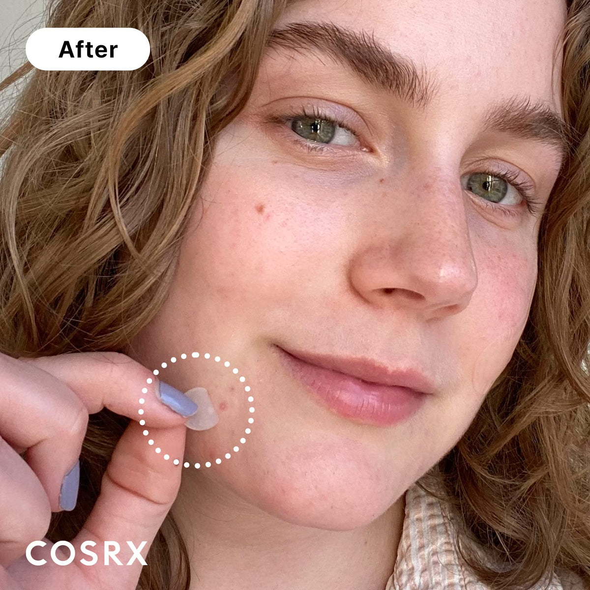 COSRX Acne Pimple Patch (96) Absorbing Hydrocolloid Original 3 Size Patches for Blemishes and Zits Cover - FENGGESTORE20