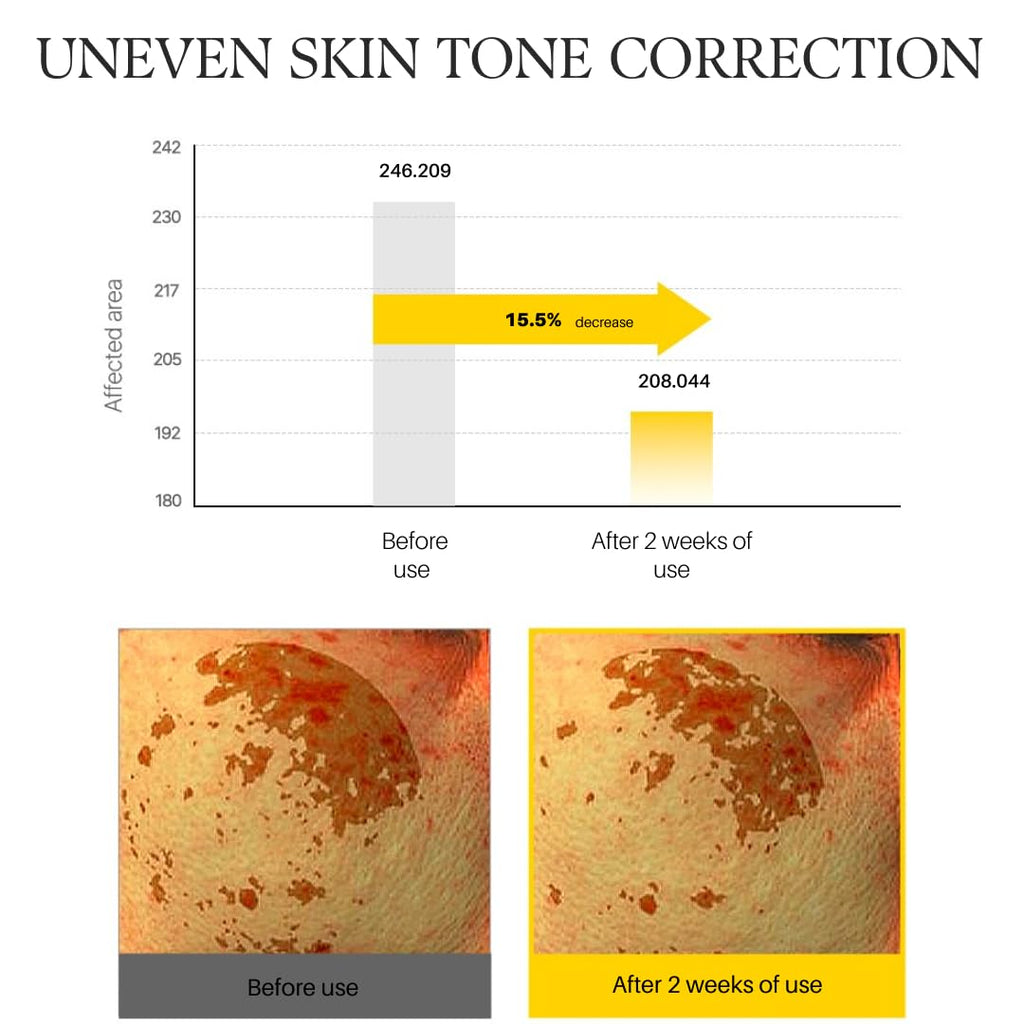 d'alba Piedmont White Truffle Vita Toning Serum Toner, Glass Skin with Double Vitamin Skincare, Face Moisturizer, (6.09 fl. oz) - FENGGESTORE20