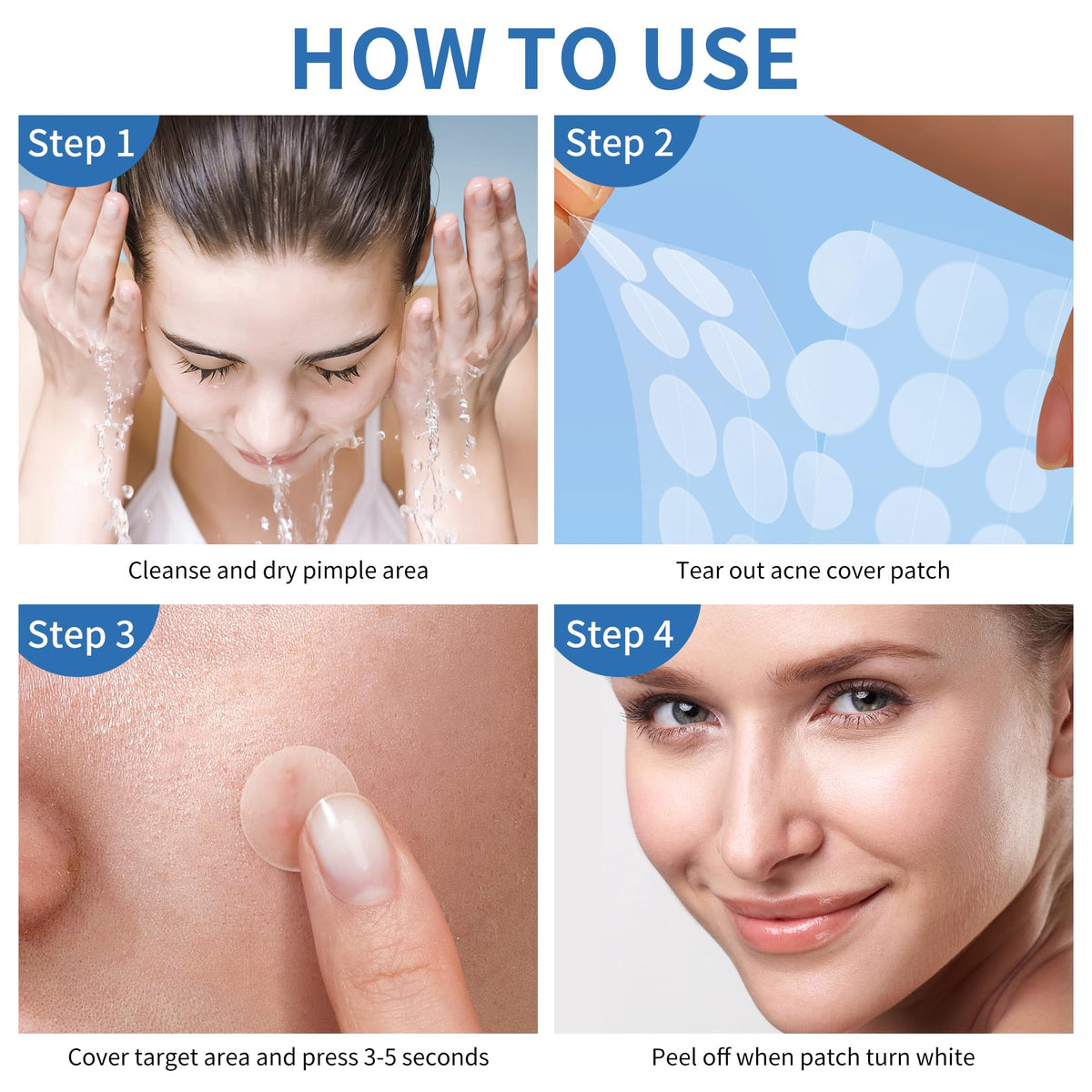 Daolyo Pimple Patches for Face, 4 Size 300 Counts Acne Patches, Hydrocolloid Patches - FENGGESTORE20