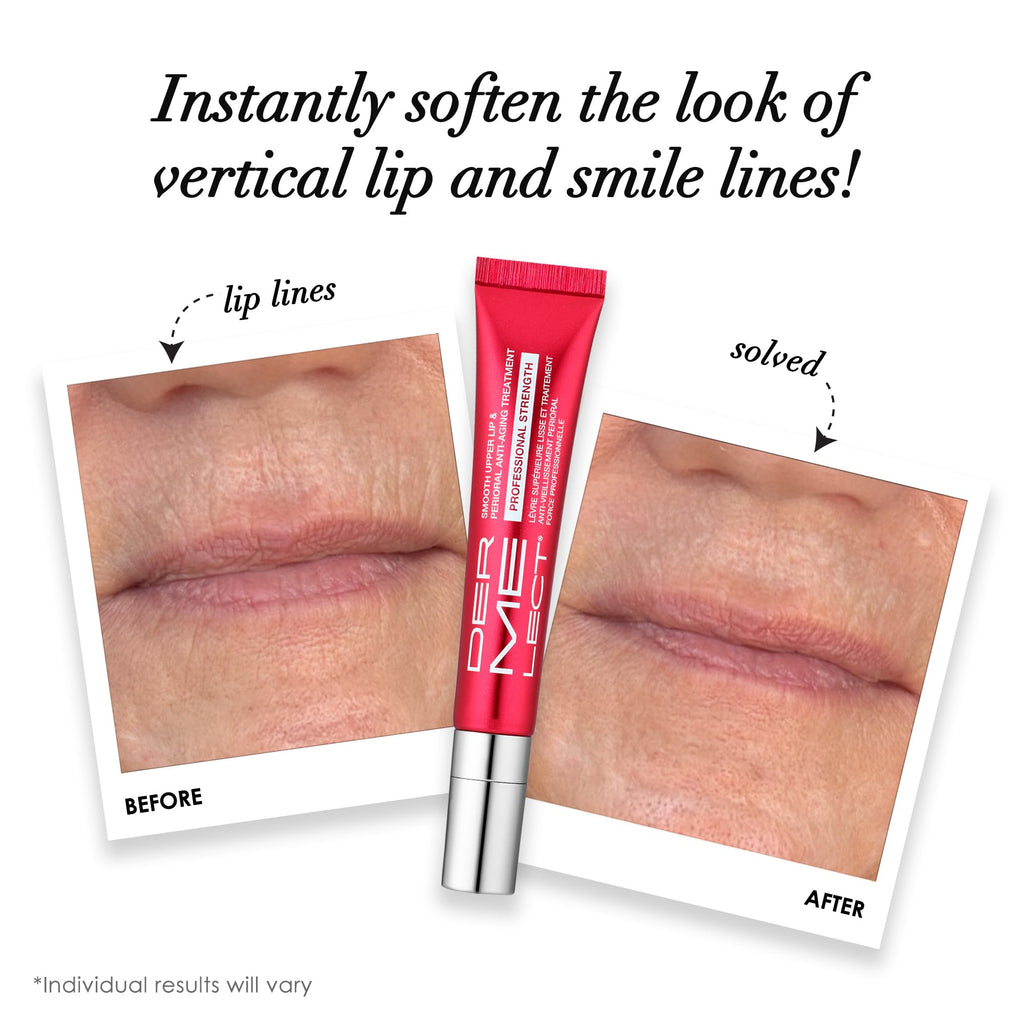 Dermelect Smooth Upper Lip & Perioral Anti-Aging Treatment - Professional Strength 15ml - FENGGESTORE20