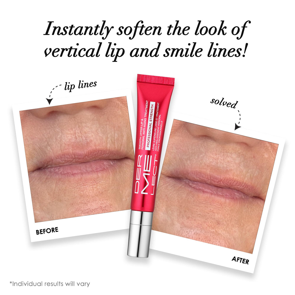 Dermelect Smooth Upper Lip & Perioral Anti-Aging Treatment - Professional Strength 15ml - FENGGESTORE20
