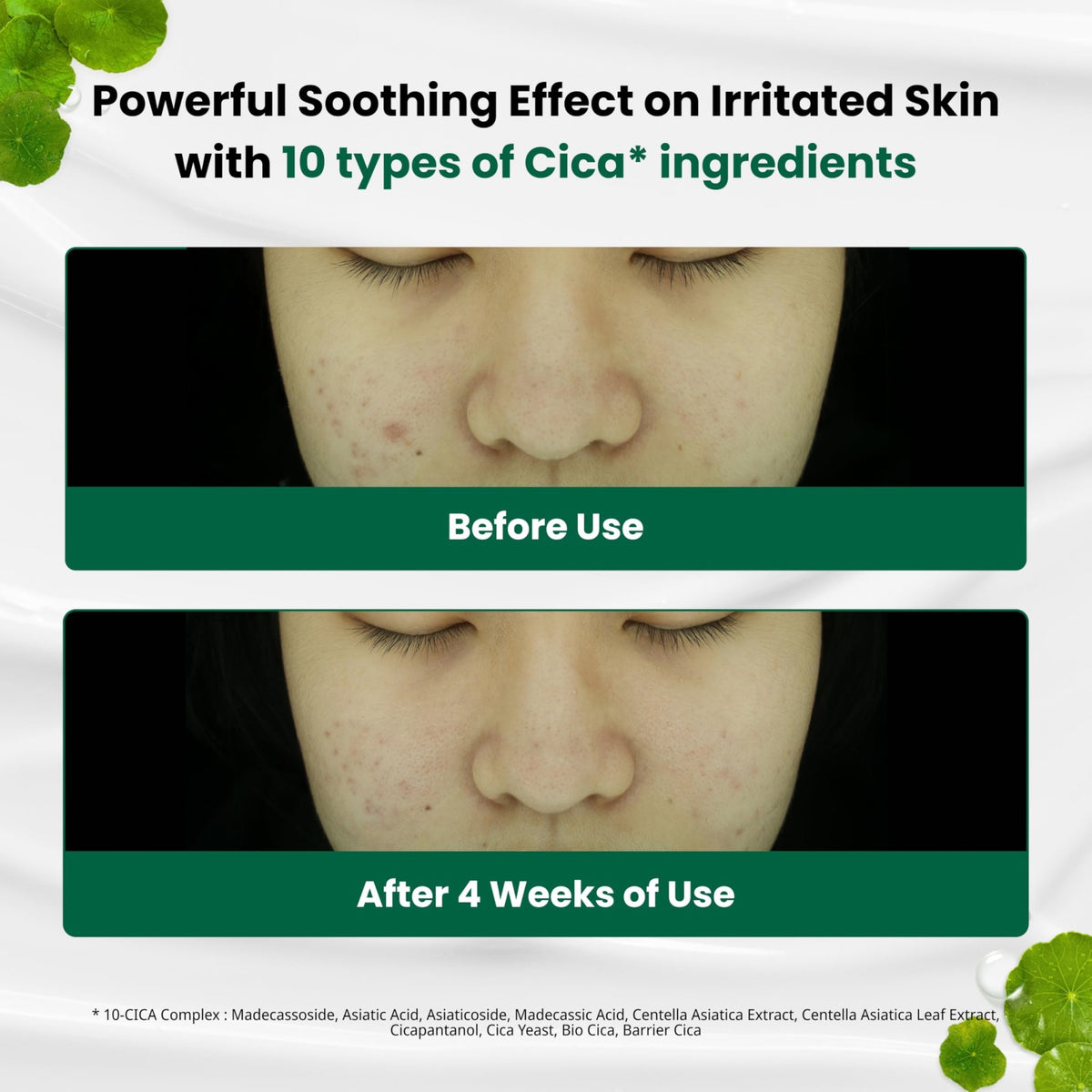 Dr. G R.E.D. Blemish Clear Soothing Cream - Calming Korean Moisturizer for Redness - Soothes Acne & Irritation - FENGGESTORE20