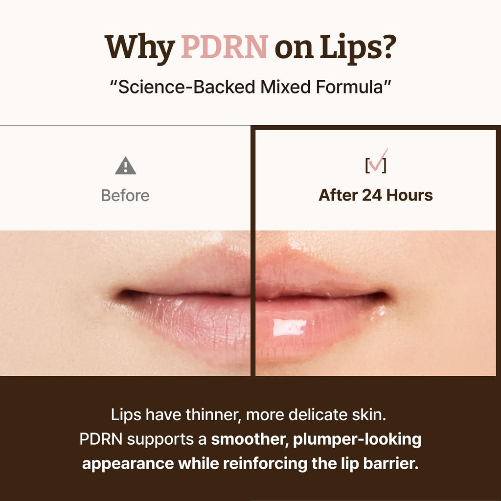 Dr. Reju-All Advanced PDRN Rejuvenating Lip Serum – Hydrating Lip Balm with Lipozip PDRN for Glowy, Dewy Lips – Gentle Exfoliating & Smoothing Lip Moisturizer – Hibiscus & Lactic Acid – 0.3 Fl Oz - FENGGESTORE20