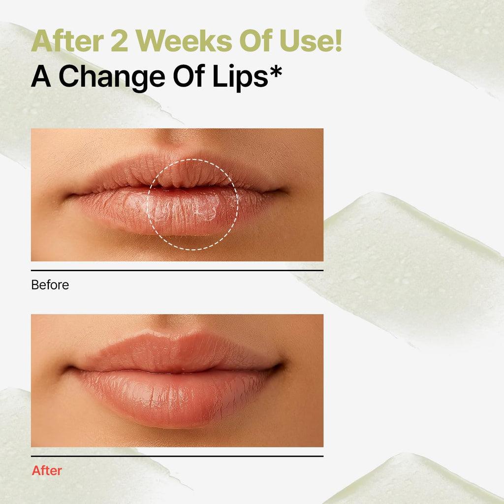 Dr.Different Retinal Lip Balm Clear, Anti-Wrinkle Lip Treatment with Deep Hydration - FENGGESTORE20