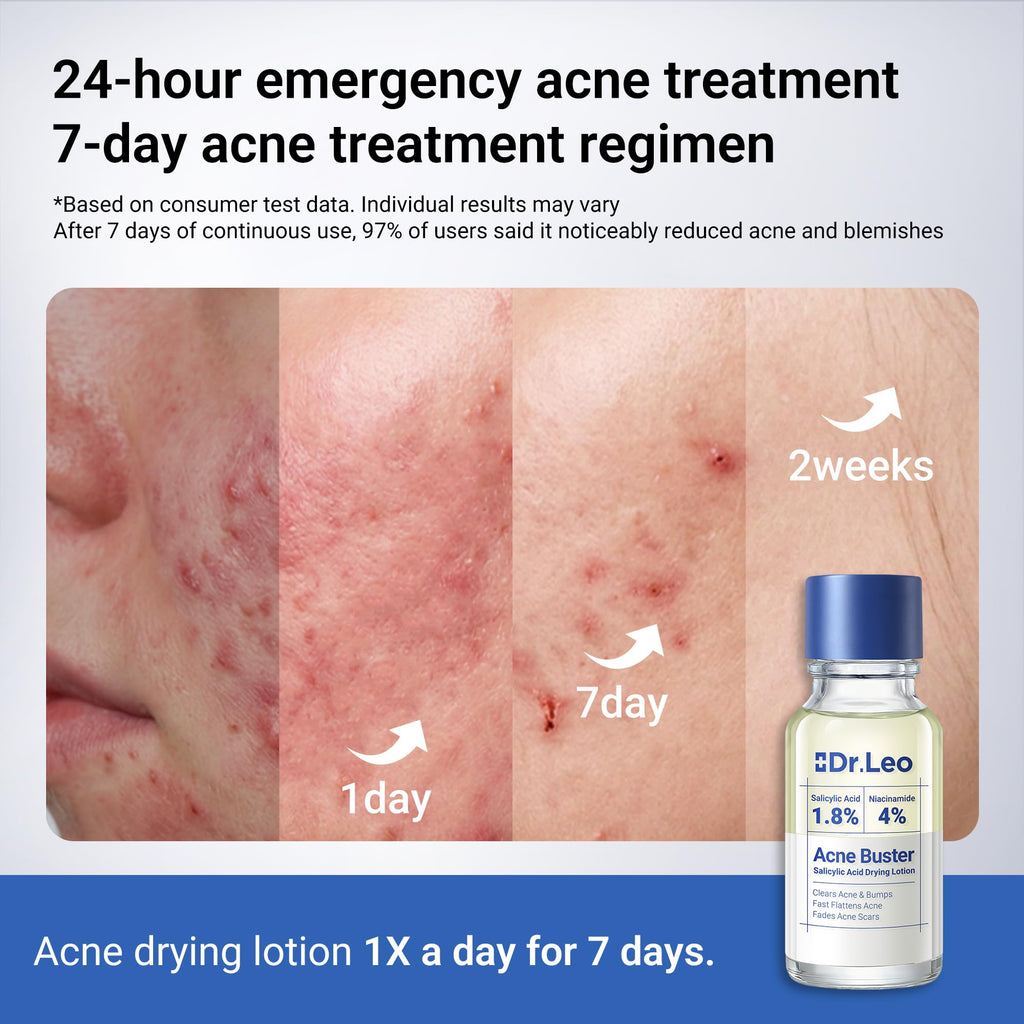 Dr.Leo 1.8% Salicylic Acid Spot Serum, Acne Treatment for Acne-Prone Sensitive Skin | Niacinamide, Fast Pimple Relief, Fades Acne Marks - FENGGESTORE20