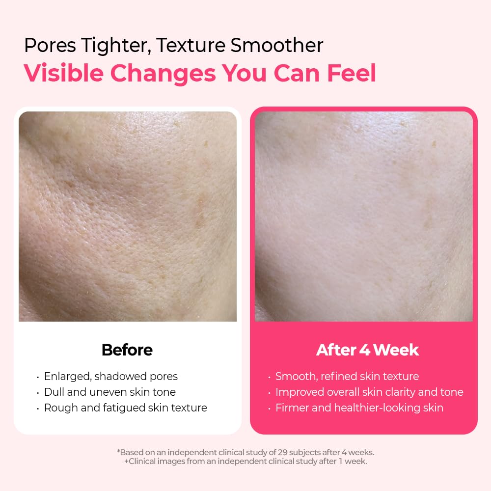Dr.Melaxin Cyano Pink Spicule Niacinamide Serum – Vitamin B12 Pore Minimizer, Liquid Microneedle Facial Treatment - FENGGESTORE20