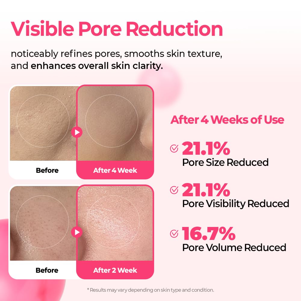 Dr.Melaxin Cyano Pink Spicule Niacinamide Serum – Vitamin B12 Pore Minimizer, Liquid Microneedle Facial Treatment - FENGGESTORE20