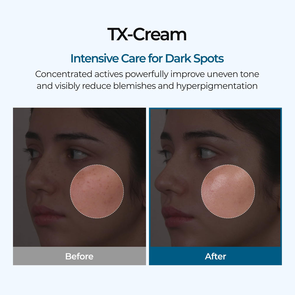 DR.Melaxin TX Tranexamic Acid CREAM | Skin freckle Cream, Blemishes, Anti-pigmetation korean skin care - FENGGESTORE20