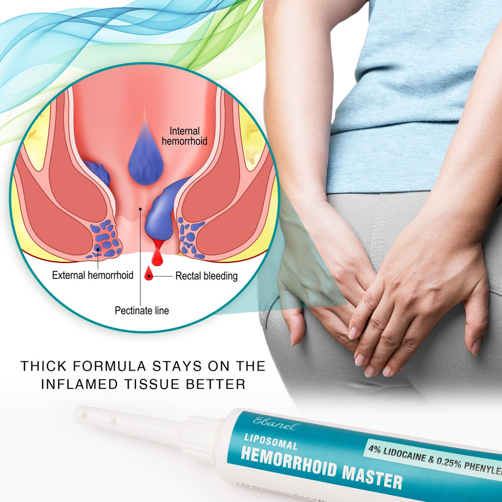 Ebanel 4% Lidocaine Hemorrhoid Treatment Ointment with Phenylephrine, Witch Hazel, Vitamin B6, Zinc Oxide, Frankincense, External and Internal Hemorrhoids Treatment Burn Itch Pain Relief Anal Cream - FENGGESTORE20