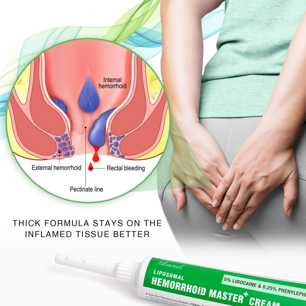 Ebanel 5% Lidocaine Hemorrhoid Treatment Cream with Witch Hazel, Phenylephrine, Horse Chestnut, Vitamin B6, Zinc Oxide, External and Internal Hemorrhoids Treatment Burn Itch Pain Relief Anal Cream - FENGGESTORE20