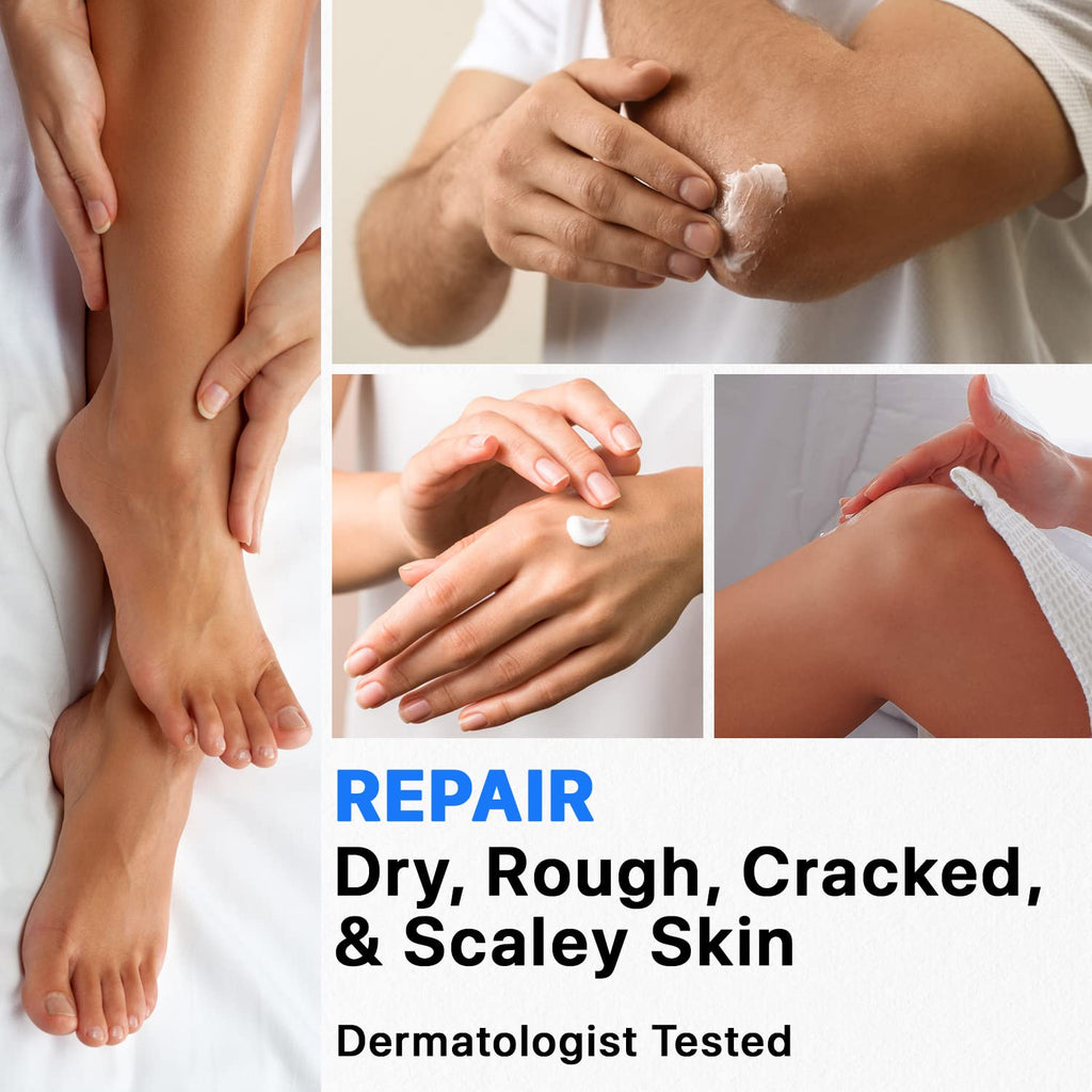Ebanel Bundle of 40% Urea Cream 2-Pack and Callus Remover Gel - FENGGESTORE20