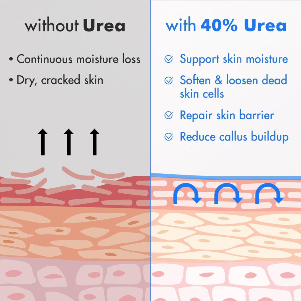 Ebanel Urea Cream 40% plus Salicylic Acid 2%, Foot Cream for Dry Cracked Heels Feet Knees Elbows Hands, Foot Dead Skin Cuticle Callus Remover Toenail Softener, Keratolytic Skin Barrier Repair - FENGGESTORE20