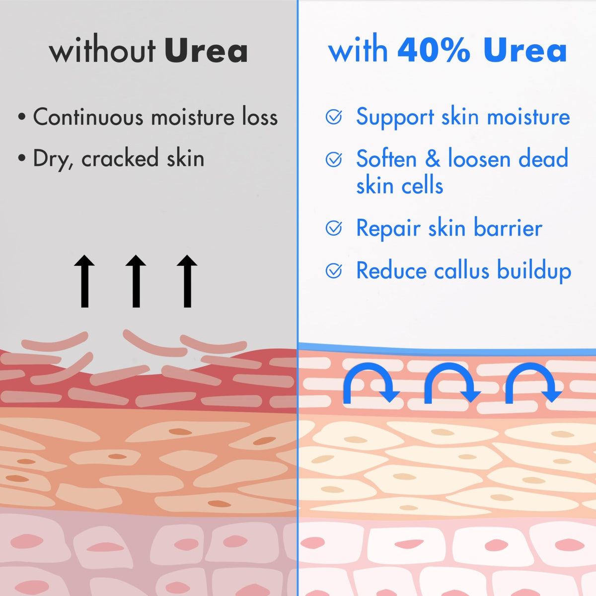Ebanel Urea Cream 40% plus Salicylic Acid 2%, Foot Cream for Dry Cracked Heels Feet Knees Elbows Hands, Foot Dead Skin Cuticle Callus Remover Toenail Softener, Keratolytic Skin Barrier Repair, 3-Pack - FENGGESTORE20