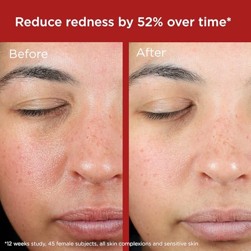 EltaMD UV Skin Recovery Green Tint 100% Mineral Sunscreen, SPF 50, Redness Correcting - FENGGESTORE20