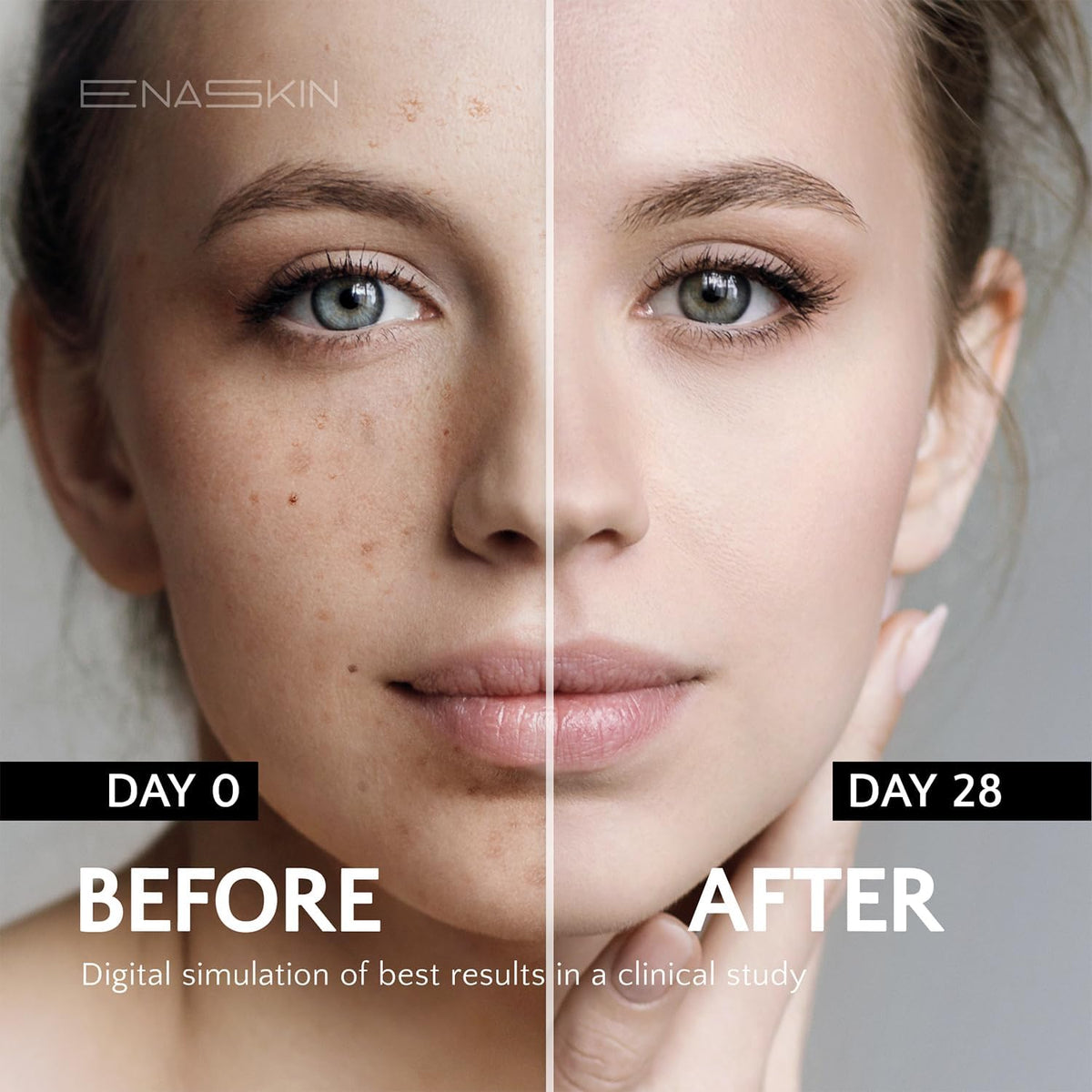 EnaSkin Dark Spot Remover for Face and Body: Advanced Formula Spot Corrector Cream to Fade Age Spots, Sun Spots, Freckles - FENGGESTORE20