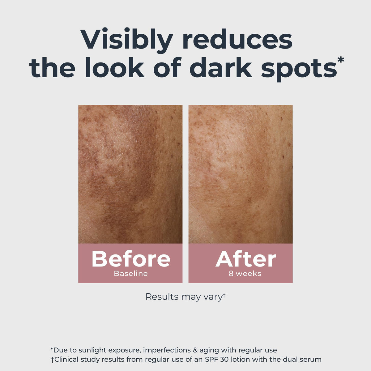 Eucerin Radiant Tone Dual Serum Dark Spot Corrector, Dark Spot Serum with Thiamidol - FENGGESTORE20