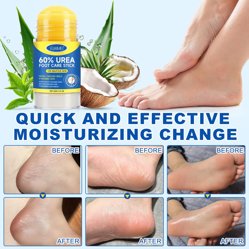 FANSHI 2 PCS Urea Stick 60% High Potency, Foot Care Urea Stick for Deeply Moisturizing & Fast Absorbing, Exfoliation for Dry Cracked Heels & Thickened Skin - FENGGESTORE20