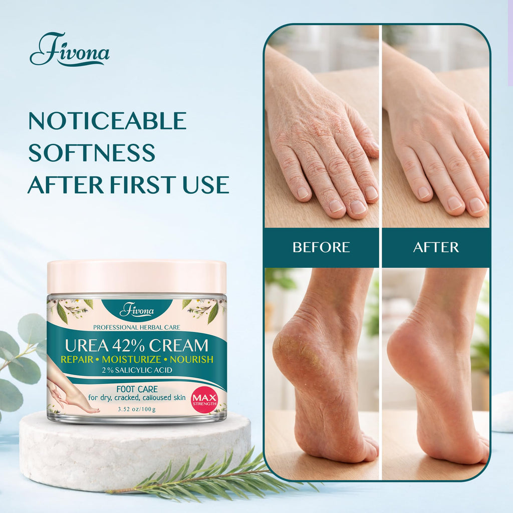 FIVONA 42% Urea Foot Cream for Thick, Rough Dry Skin - Maximum Strength Callus Softening with 2% Salicylic Acid, Tea Tree & Aloe Vera, 100g (3.5 oz) - Deep Moisturizing Foot Care - FENGGESTORE20