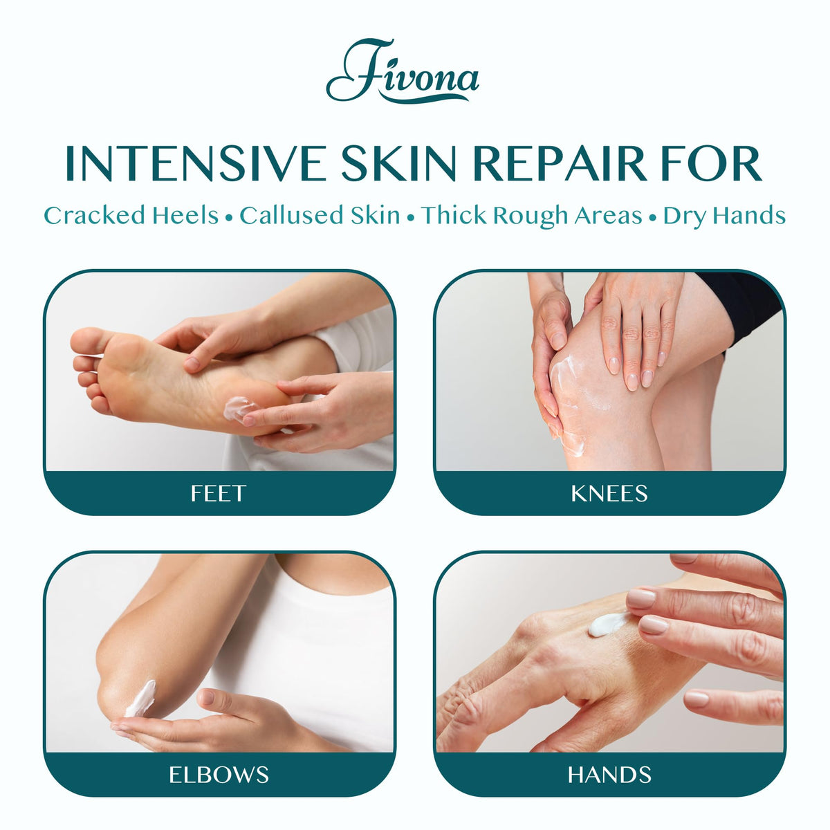 FIVONA 42% Urea Foot Cream for Thick, Rough Dry Skin - Maximum Strength Callus Softening with 2% Salicylic Acid, Tea Tree & Aloe Vera, 100g (3.5 oz) - Deep Moisturizing Foot Care - FENGGESTORE20