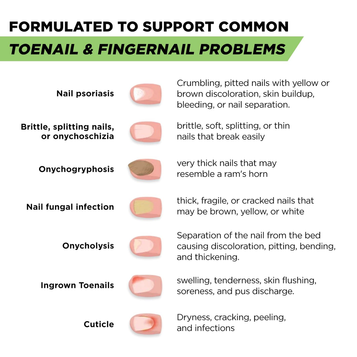 Footcure Antifungal Nail Treatment Pen – Extra Strength Toenail Fungus Treatment - FENGGESTORE20