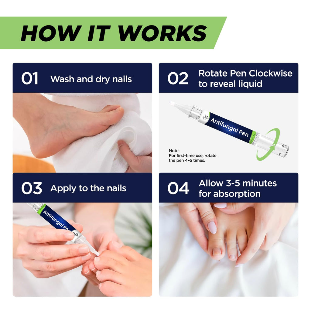 Footcure Antifungal Nail Treatment Pen – Extra Strength Toenail Fungus Treatment - FENGGESTORE20
