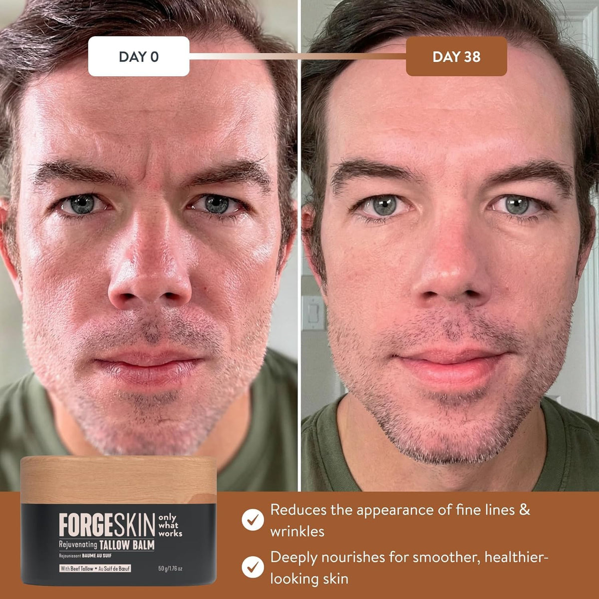 Forge Skin® Wrinkle Defense Beef Tallow Balm for Men [TALLOW-BASED] Moisturizer for Face Hydration - Hydrating Anti Aging Skin Cream - FENGGESTORE20